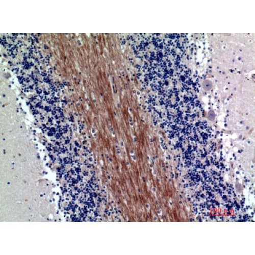 Polyclonal Rabbit anti-Human SIRPA / CD172a Antibody (281-330 aa, Internal, IHC, WB)