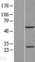 RBM42 Protein (Over-Expression Lysate Myc-DDK (Flag))