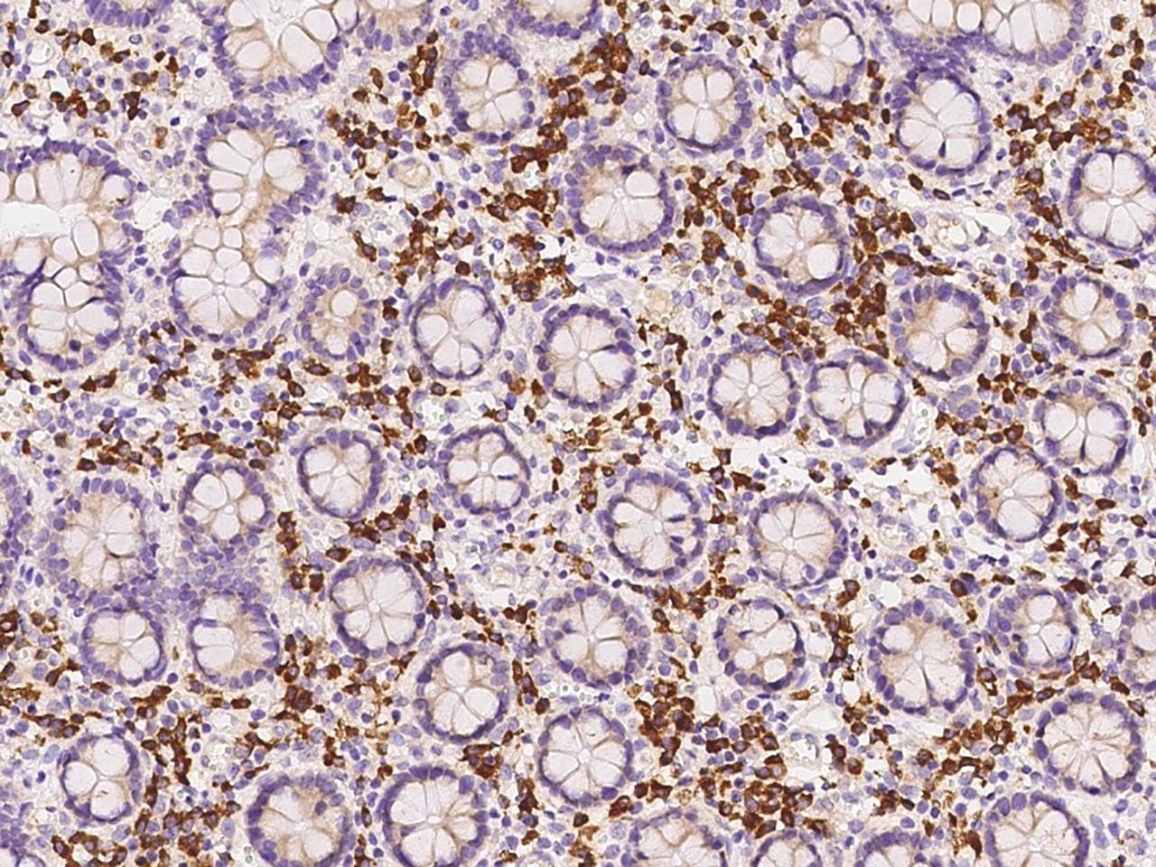 Polyclonal Rabbit anti-Human PABPC4 Antibody (IHC, IF, WB)