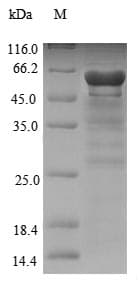 Aspergillus fumigatus NRPS1 Protein (Recombinant 6His-SUMO, N-terminus)