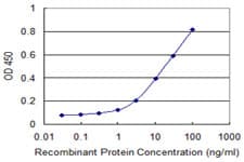 CLTC / Clathrin Heavy Chain Antibody (clone 2E5)