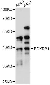 B1R / BDKRB1 Antibody