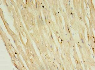 Polyclonal Rabbit anti-Human PLN / Phospholamban Antibody (IHC)