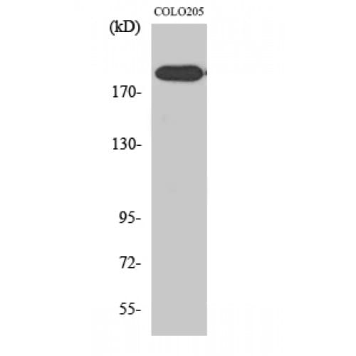 ERCC5 / XPG Antibody (100-180 aa, N-terminal)