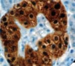 ENO2 / NSE Antibody (Ready-to-Use)