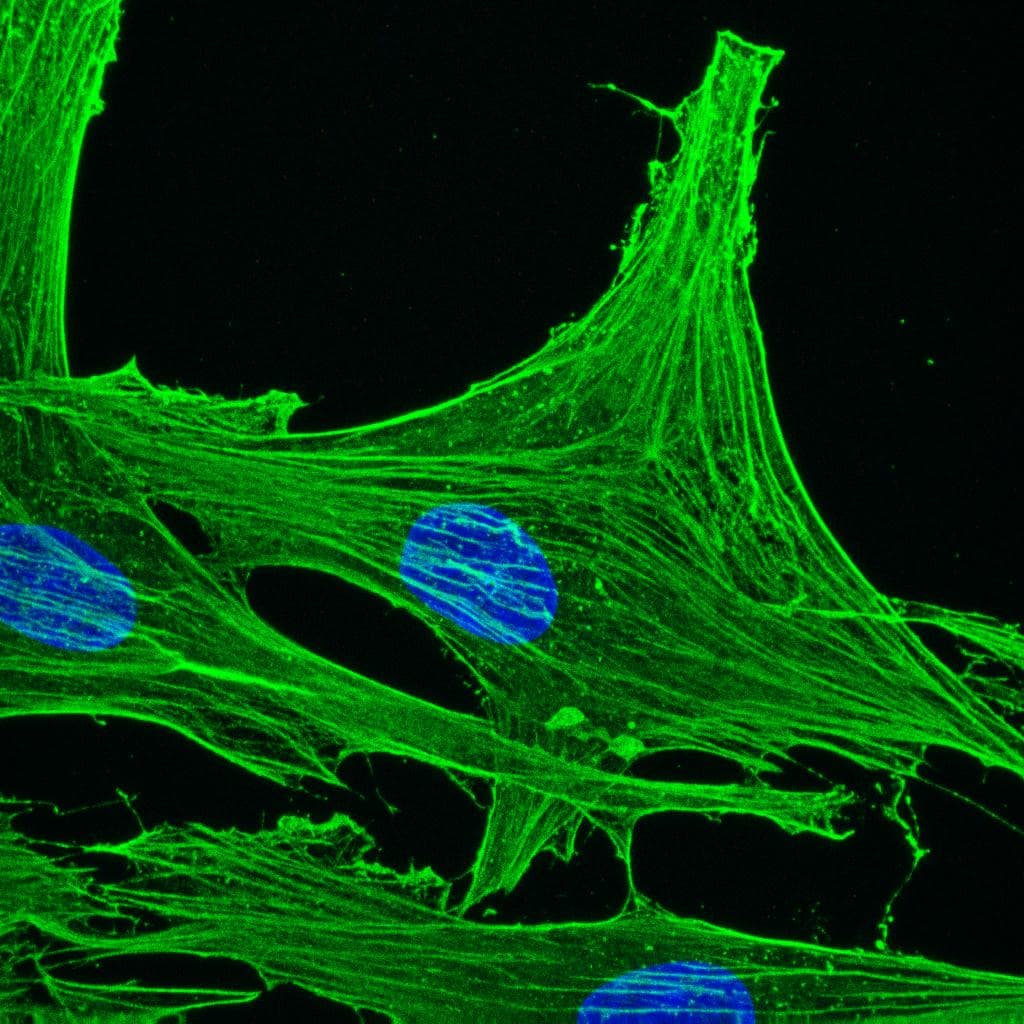 IHC-plus™ Monoclonal Mouse anti-Human ACTG1 / Gamma Actin Antibody (clone 2A3, IHC, WB)