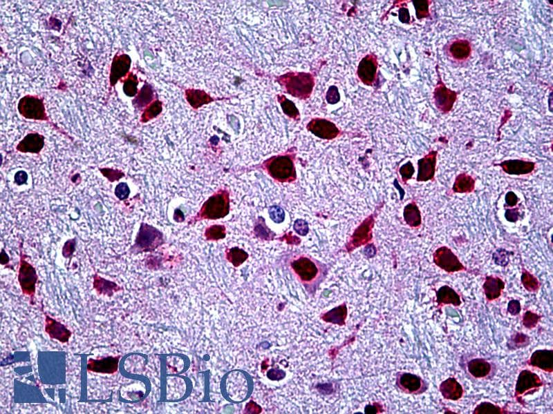 IHC-plus™ Monoclonal Mouse anti-Human SFPQ Antibody (clone 6D7, IHC, IF, WB)