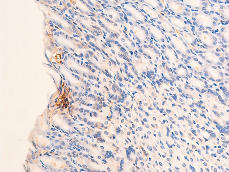 CHEK2 / CHK2 Antibody (phospho-Thr68)