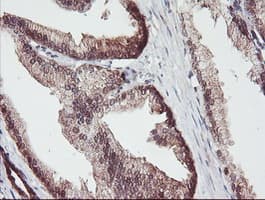 ACY1 / Aminoacylase 1 Antibody (clone OTI2F1)