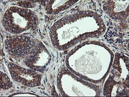 UBE2J1 Antibody (clone OTI1F6)