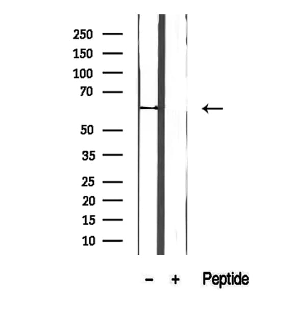 FBXW7 / FBW7 Antibody