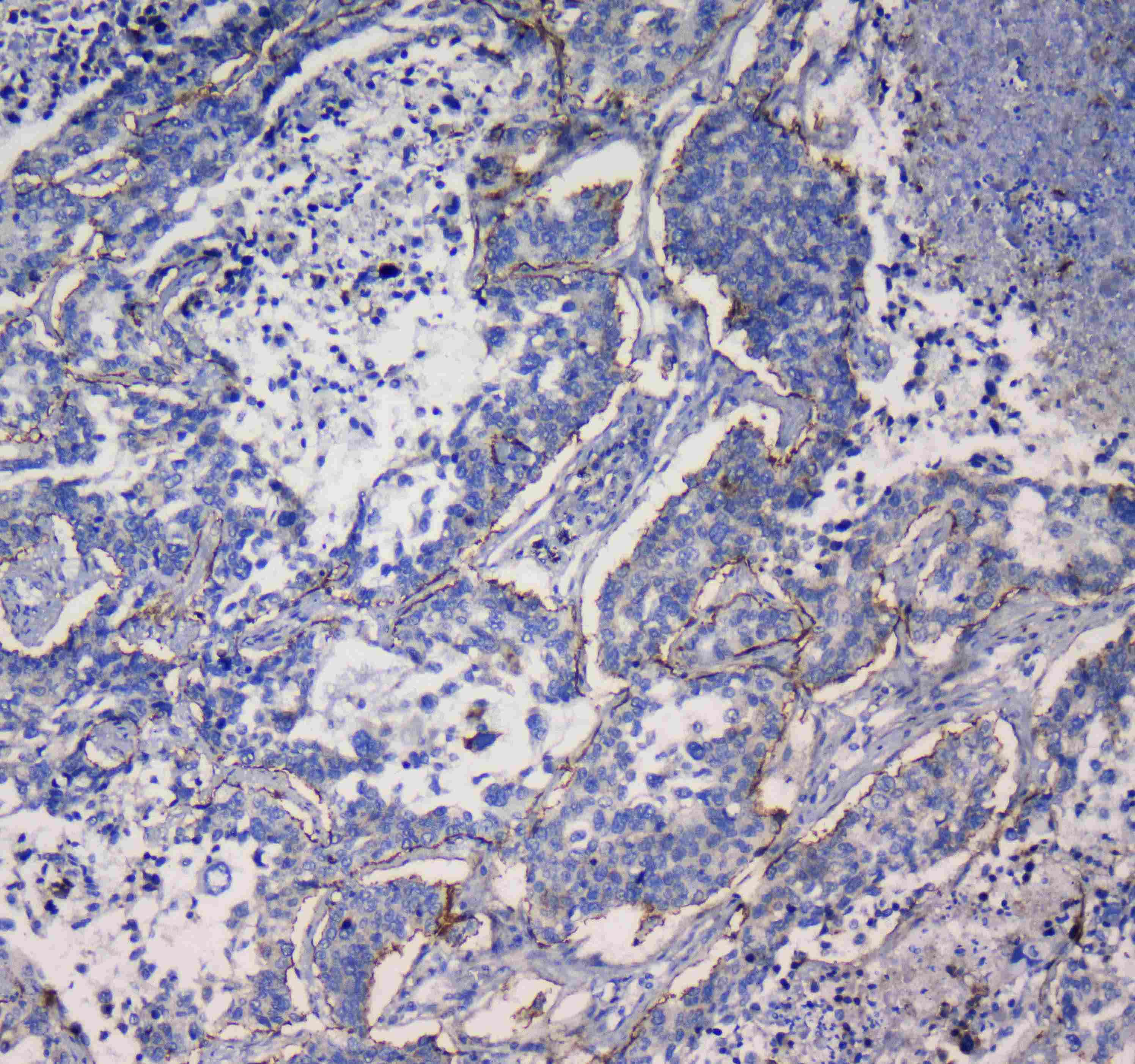 Polyclonal Rabbit anti-Human ITGA5/Integrin Alpha 5/CD49e Antibody (IHC, WB)