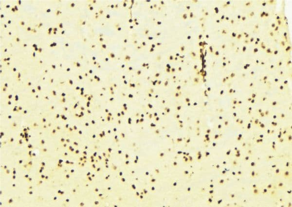 Polyclonal Rabbit anti-Human SIRT7 / Sirtuin 7 Antibody (IHC, WB)