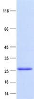 Human RHOB Protein (Recombinant Myc-DDK (Flag), C-terminus)