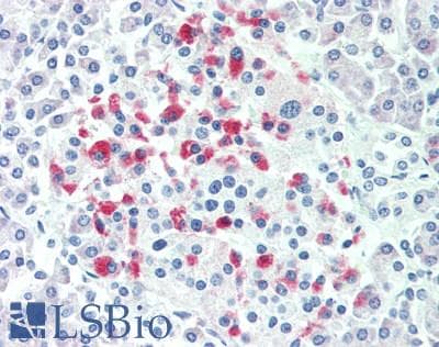 IHC-plus™ PDE3B Antibody (aa1062-1112)
