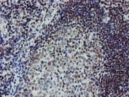 METTL16 / METT10D Antibody (clone OTI3B5)