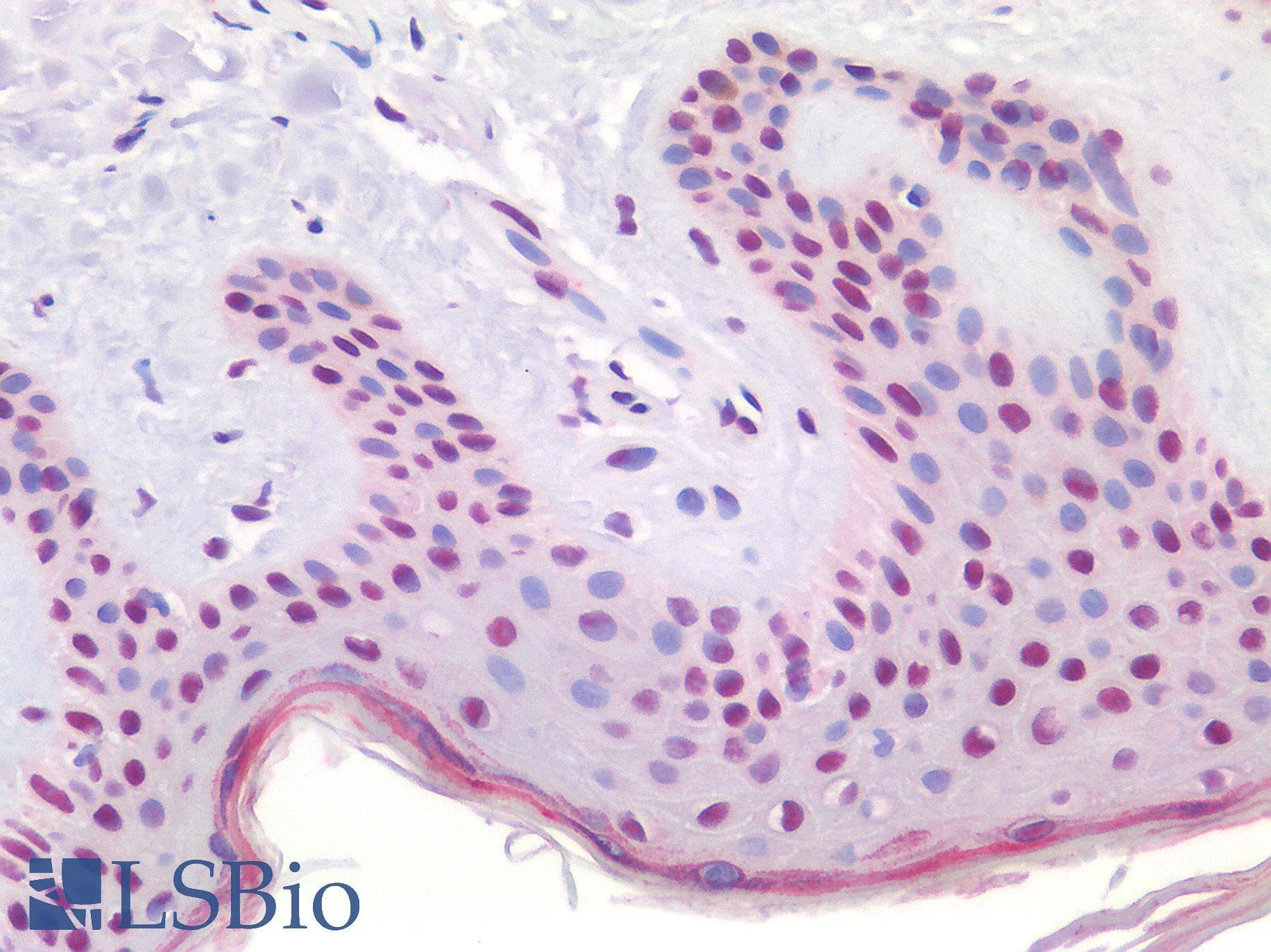 IHC-plus™ TERT / Telomerase Antibody