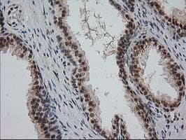 Monoclonal Mouse anti-Human MGLL / Monoacylglycerol Lipase Antibody (clone OTI1H1, IHC, IF, WB)