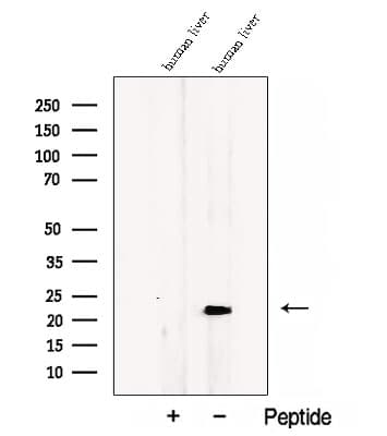 Polyclonal Rabbit anti-Human CCDC53 Antibody (IF, WB)