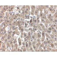 LDLR / LDL Receptor Antibody