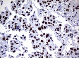 NBN / Nibrin Antibody (clone OTI2E10)