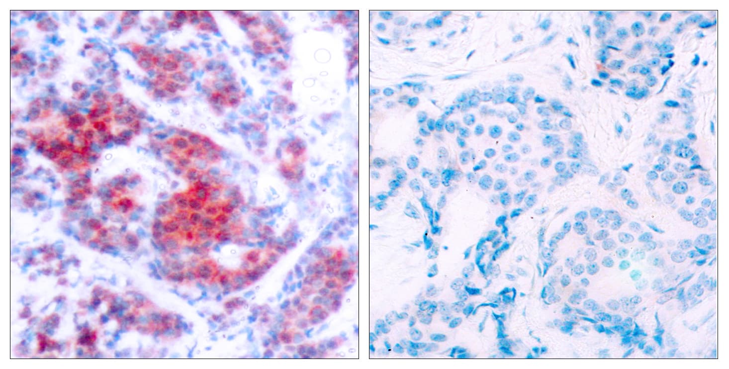 STAT4 Antibody (phospho-Tyr693)
