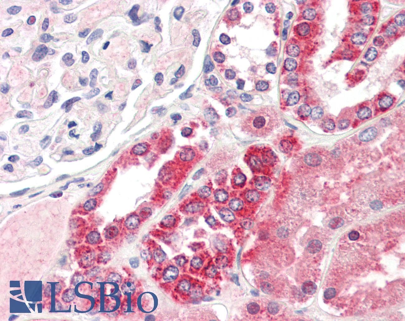 IHC-plus™ TYK2 Antibody (Val1048)