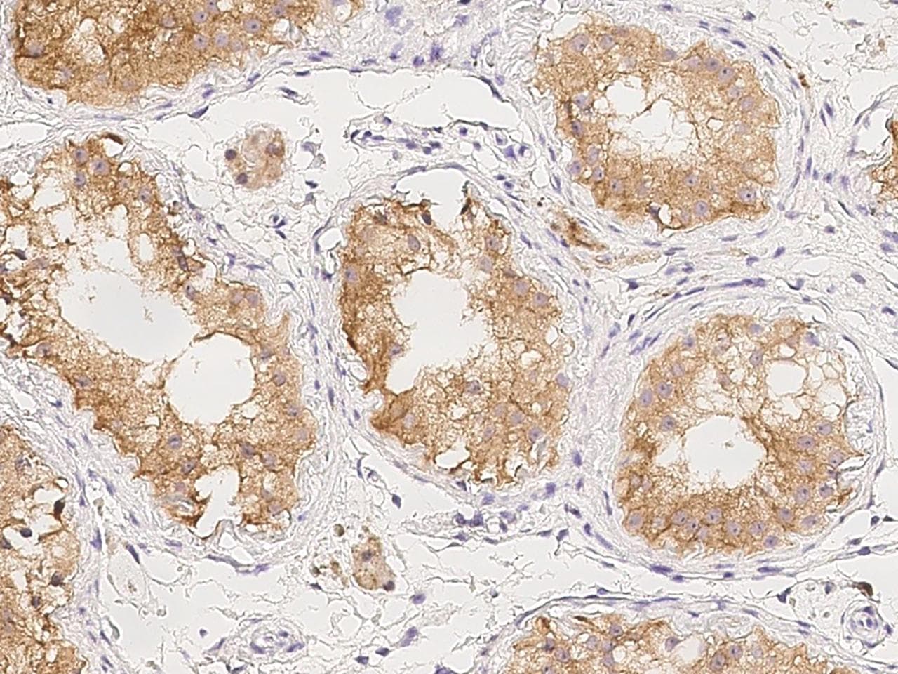 KCTD4 Antibody