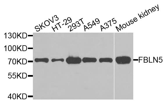IHC-plus™ Polyclonal Rabbit anti-Human FBLN5 / Fibulin 5 Antibody (IHC, WB)