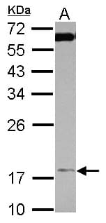 TIMM17A / TIM17 Antibody