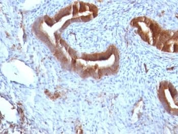 B2M / Beta 2 Microglobulin Antibody (clone B2M/961, Ready-to-Use)