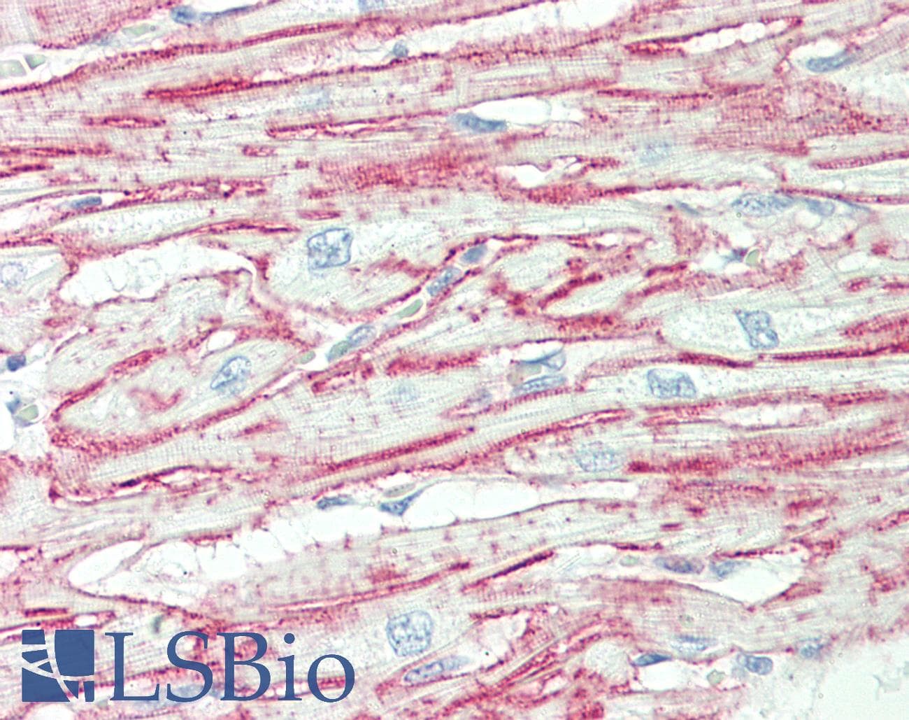 IHC-plus™ ITGA6/Integrin Alpha 6/CD49f Antibody (aa324-620, clone 129CT49.6.5)
