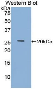 DLD / Diaphorase / E3 Antibody (aa280-487)