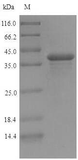 Soy Bean Ferritin-2, chloroplastic Protein (Recombinant 6His-SUMO, N-terminus)