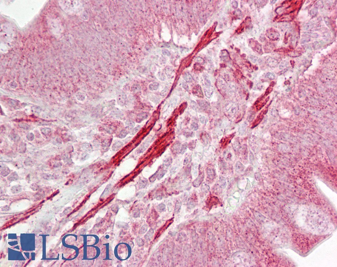 ROCK2 Antibody (aa511-560)
