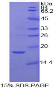 Human IGFBP3 Protein (Recombinant His)
