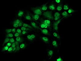 ERCC1 Antibody (clone OTI1C10, Carrier-free)