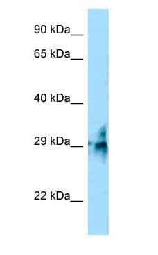 TMUB2 Antibody (aa224-273)
