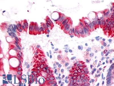 PathPlus™ Prostaglandin D2 Receptor Antibody (Extracellular Domain)