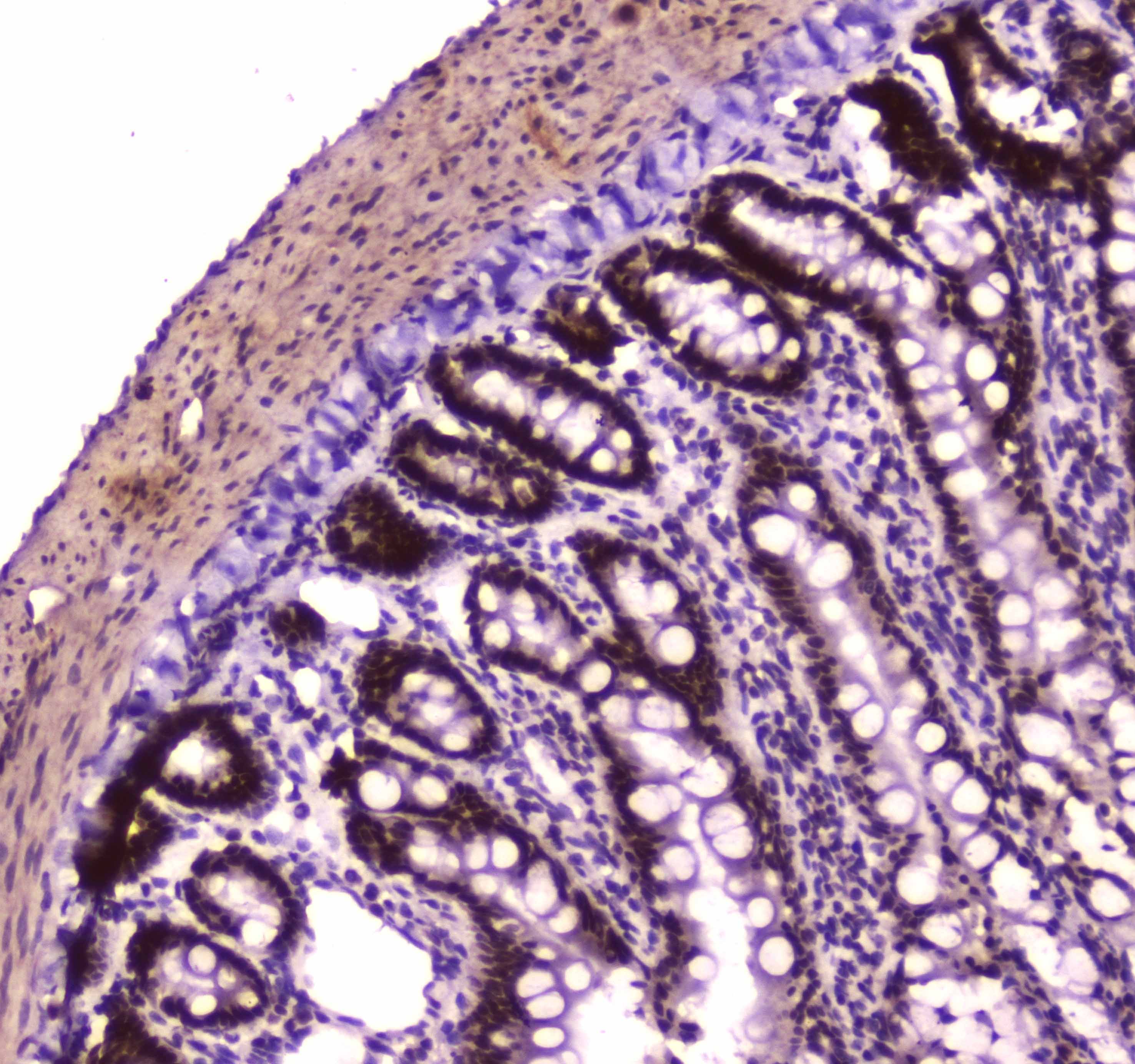Polyclonal Rabbit anti-Human SMARCA4 / BRG1 Antibody (IHC, WB)