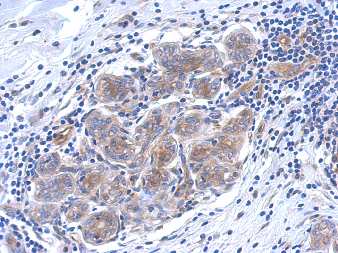 Polyclonal Rabbit anti-Human SERPINB6 / PI-6 Antibody (aa66-313, IHC, WB)