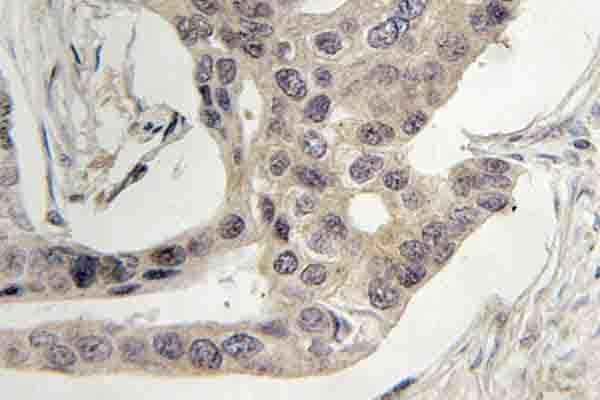 Polyclonal Rabbit anti-Human LCP2 / SLP-76 Antibody (Gly122, IHC, WB)