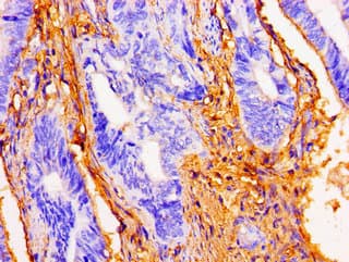 DSG1 / Desmoglein 1 Antibody