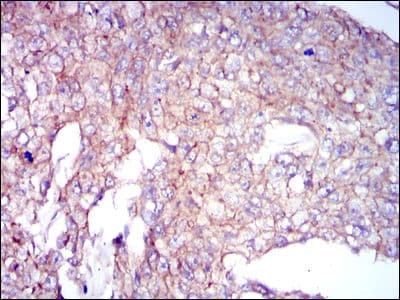 Monoclonal Mouse anti-Human CLP / COTL1 Antibody (clone 5C8, IHC, WB)
