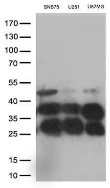 CTSL / Cathepsin L Antibody (aa114-333, clone OTI5A5)