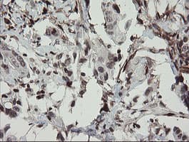 F13A1 / Factor XIIIa Antibody (clone 6F5, Carrier-free)