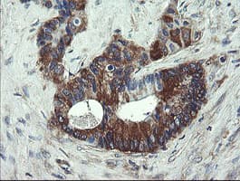 Monoclonal Mouse anti-Human VBP1 Antibody (clone OTI2C2, IHC, WB)