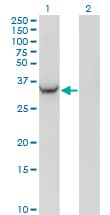 Monoclonal Mouse anti-Human BABP / AKR1C2 Antibody (clone 3C11, WB)