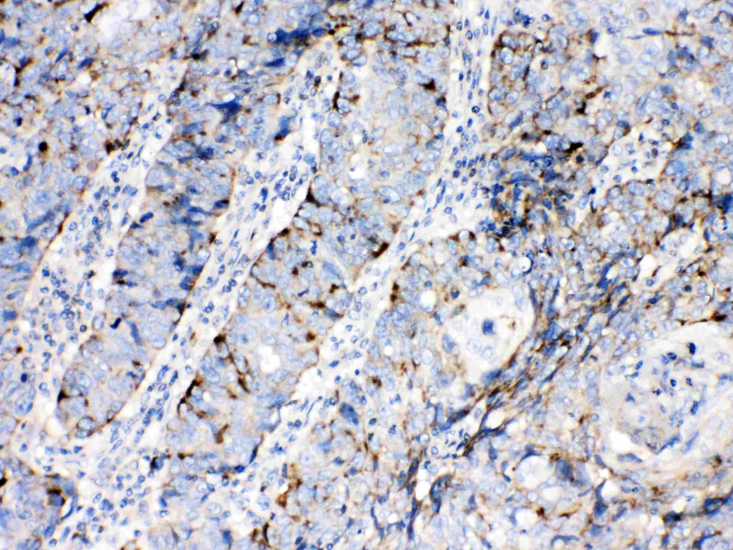 BAX Antibody