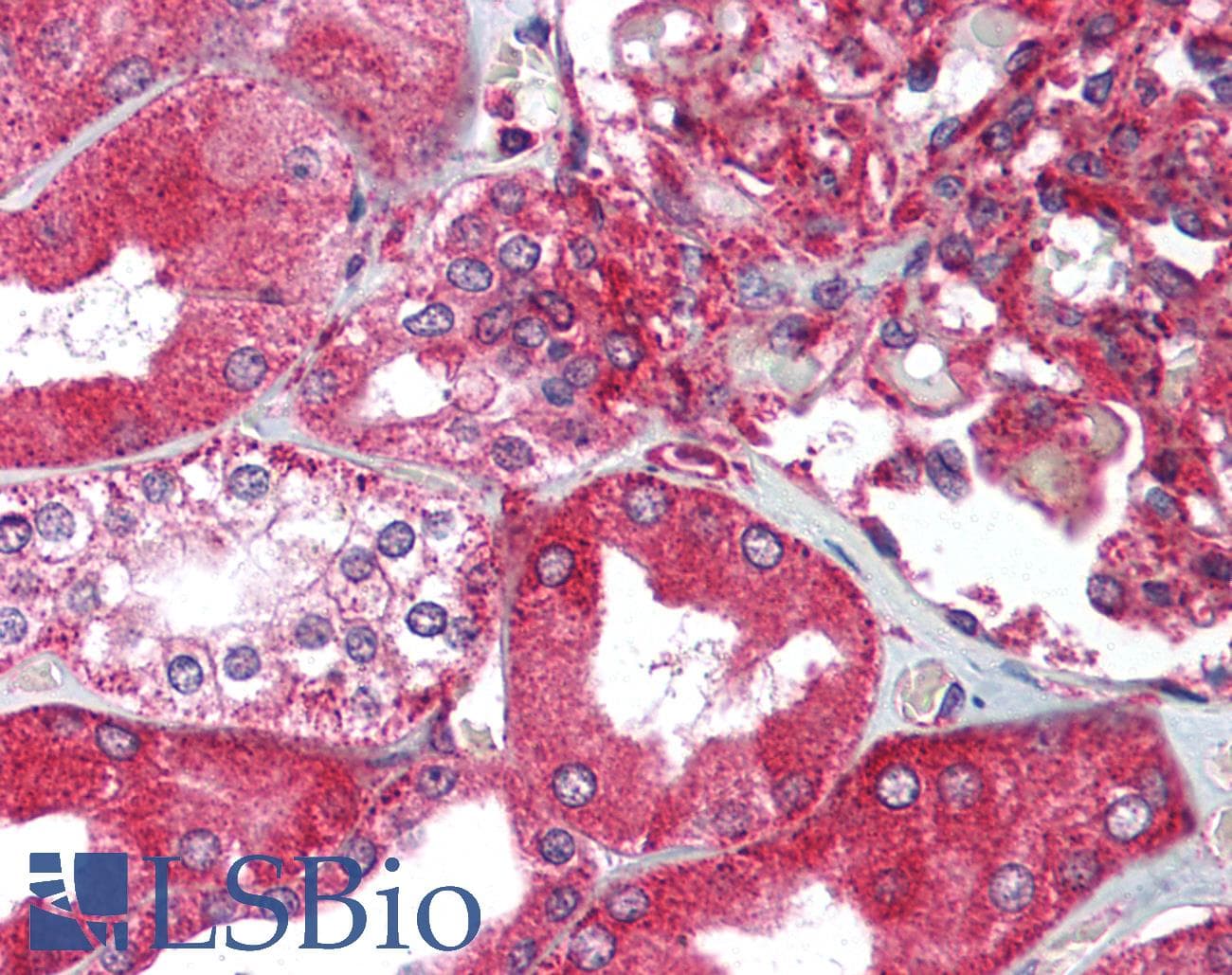 IHC-plus™ XBP1 Antibody